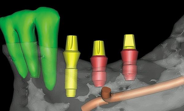 cone beam ct