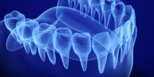 bone grafting model