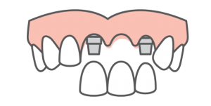 multi-tooth replacement icon